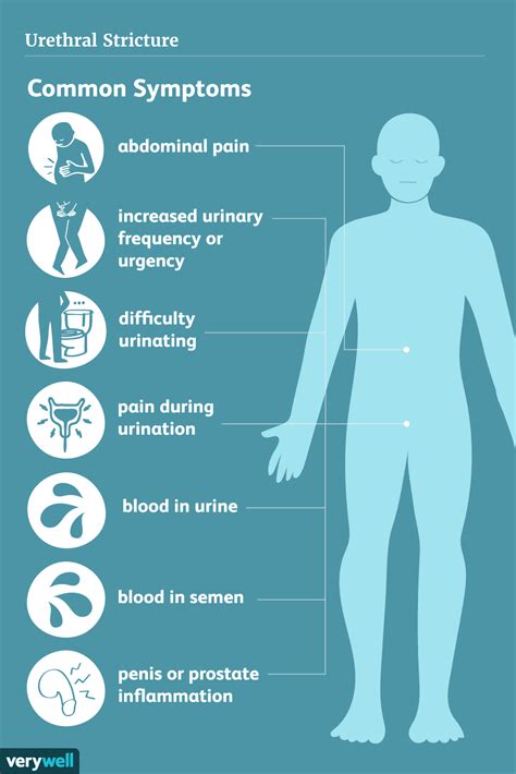 Urethral Stricture Symptoms