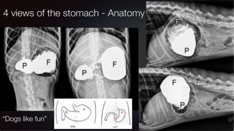 Radiology Abdomen 8 Git Flashcards Quizlet