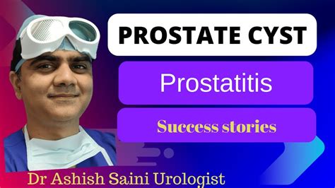 Prostatitis With Prostatic Cyst Treatment Review Youtube