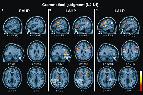 Early Setting Of Grammatical Processing In The Bilingual Brain Neuron