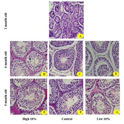 Micrograph Of Seminiferous Tubules In Left Testis Of Lambs Fed High