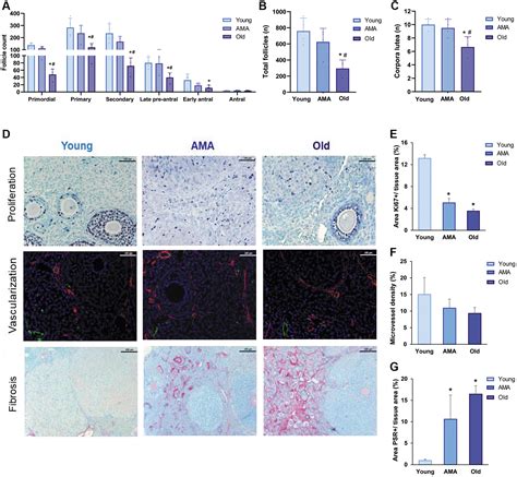 Deciphering Reproductive Aging In Women Using A Nod Scid Mouse Model