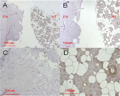 DEFA1 3 Immunostaining In Pleomorphic Adenoma Tissue Primary