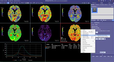 Brain Perfusion Tda Advanced Tour Terarecon Advanced Visualization