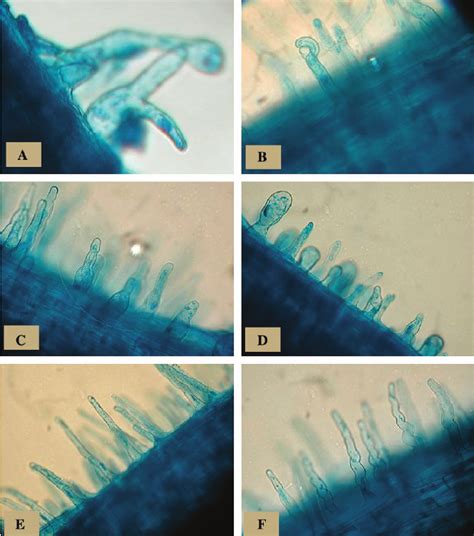 Types Of Root Hair Deformations Manifested By Nod Factor Treatments