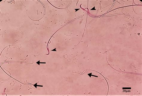 Sperm Vitality Assessment Using The Eosin Staining Method Arrowheads Download Scientific