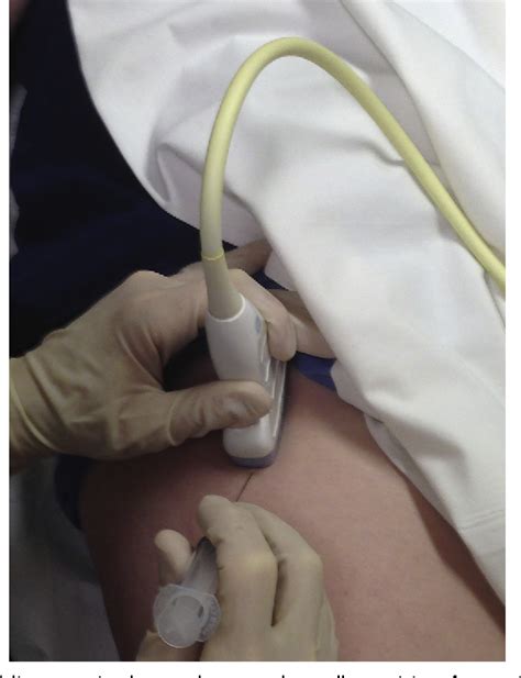 Ultrasound-Guided Hip Procedures. | Semantic Scholar