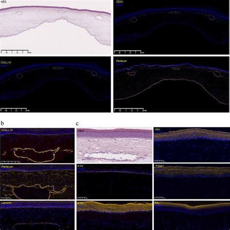 Histological Analysis And Immunostaining Of The Skin Equivalent With