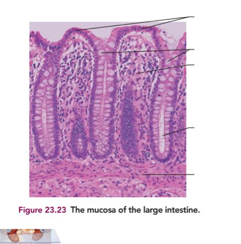 mucosa   large intestine diagram diagram quizlet