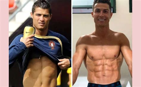 Cristiano Ronaldo antes e depois procedimentos estéticos vida