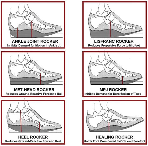 Best Rocker Bottom Shoes For Plantar Fasciitis - cloudshareinfo