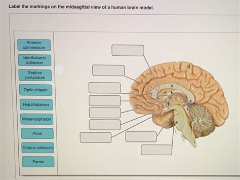 Solved Label The Markings On The Midsagittal View Of A Human