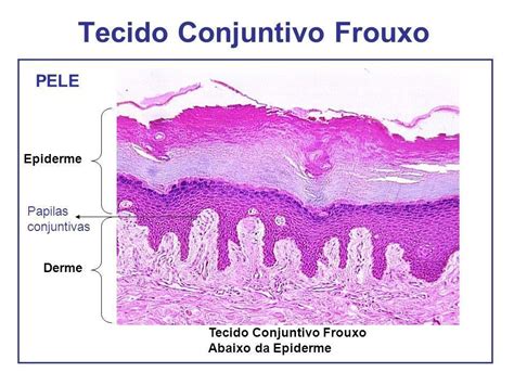 MAPA MENTAL SOBRE TECIDO CONJUNTIVO STUDY MAPS