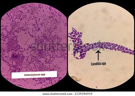 enterococcus spp images stock  vectors shutterstock