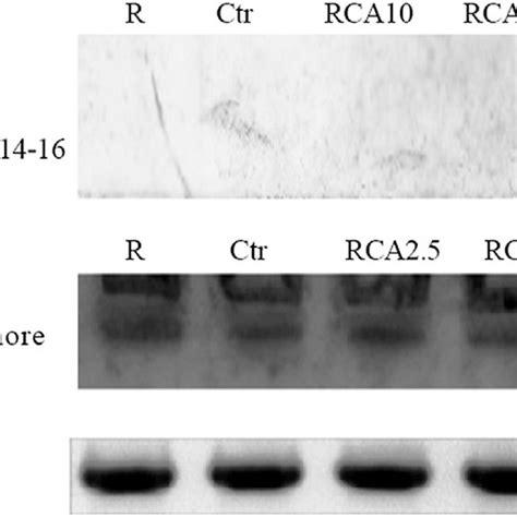 Western Blot Analysis Of Protein A Synuclein A Western Blot Analysis