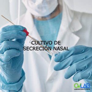 Cultivo De Secreci N Tica Der Ovlab O V Laboratorios