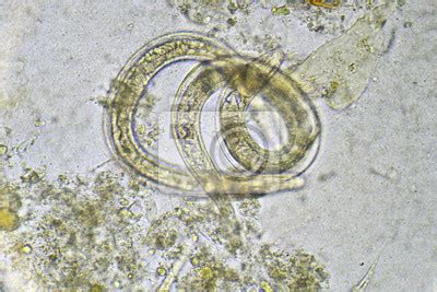 Fototapeta Egg Of Ascaris Lumbricoides In Stool Analyze By Microscope