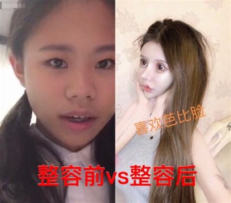 女網紅13歲開始整容，整容60次花100萬，前後對比如換頭 每日頭條