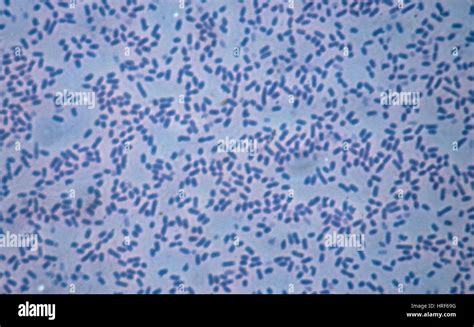 Enterobacter Cloacae Gram Stain