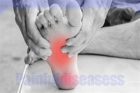 Foot Arch Pain Causes? - Painful Diseases