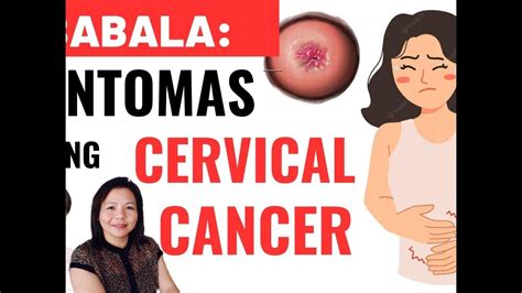 Sintomas Ng Cervical Cancer Tips By Dr Freida Ilano Labesores Ob