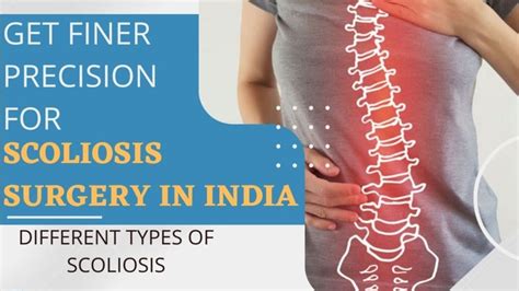 Get Finer Precision For Scoliosis Surgery In India Ankush Bajaj