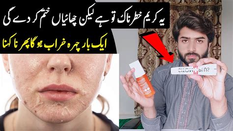 Siton Plus Cream Review Chaiyon Ka Ilaj Medicated Cream Beauty