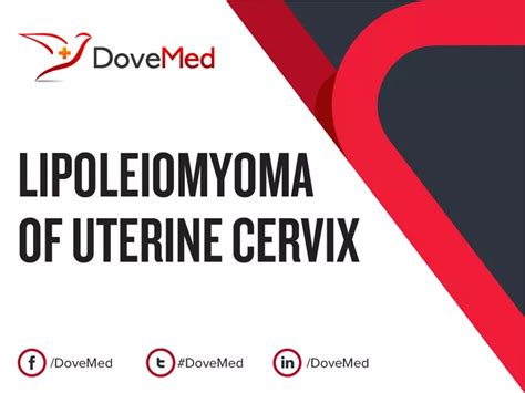 Lipoleiomyoma Of Uterine Cervix DoveMed