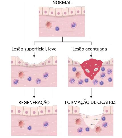 Reparo de Tecidos entenda mais sobre a Regeneração Tecidual Sanar