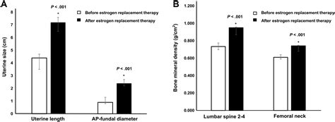 The Efficacy Of Long Term Estrogen Replacement Therapy In Turner Syndrome Women With Premature