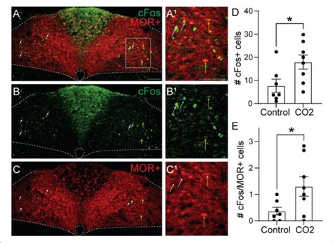 Hypercapnia Activates MOR Negative Neurons Identification Of CFos