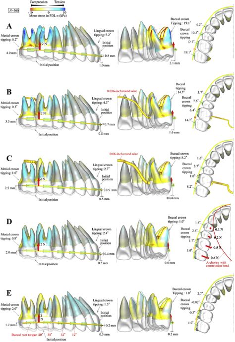 Tooth Movement Patterns At N When Intrusive Forces Are Applied