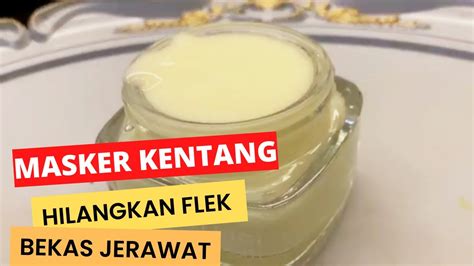 MASKER KENTANG AMPUH MENGHILANGKAN FLEK HITAM BEKAS JERAWAT Cara