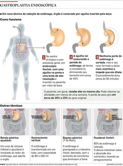 é Normal Sentir Dor No Estômago Depois Da Endoscopia