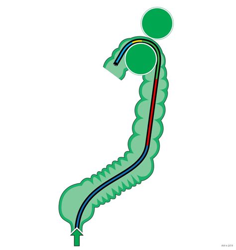 Splenic Flexure Of Colon