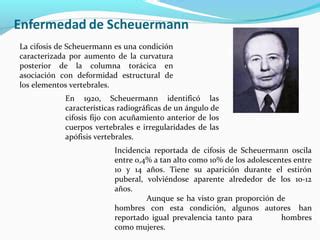 Enfermedad De Scheuermann 1 PPT