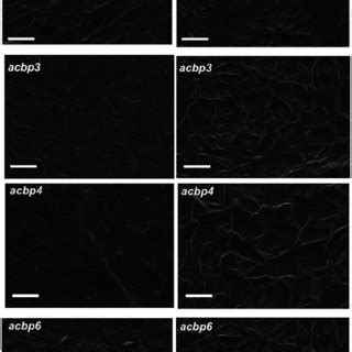 Biochemical Profiles Of Cuticular Wax And Cutin Monomers In Acbp