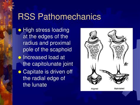 Ppt Slac Wrist Powerpoint Presentation Free Download Id1099204