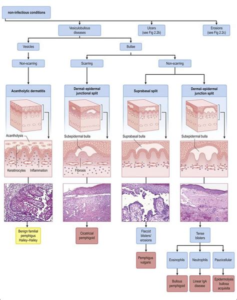 Vulvar Dermatoses And Infections Basicmedical Key