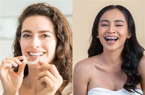 Invisalign Vs Braces Which Is The Better Option Uplarn