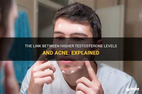 The Link Between Higher Testosterone Levels And Acne Explained Medshun