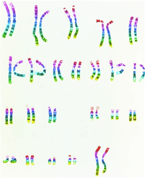 Coloured Lm Of A Normal Female Karyotype Photograph by L. Willatt, East Anglian Regional ...