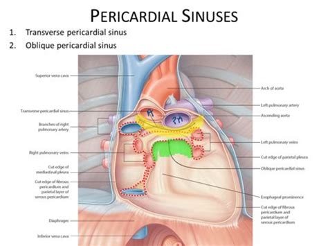 Pin em Pericardial Sinuses