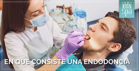 En Qu Consiste Una Endodoncia O Tratamiento De Conductos