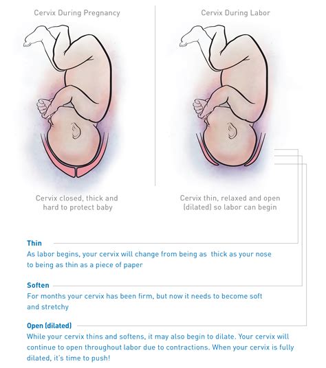 5 How To Tell If Your Dilated Trending Hutomo