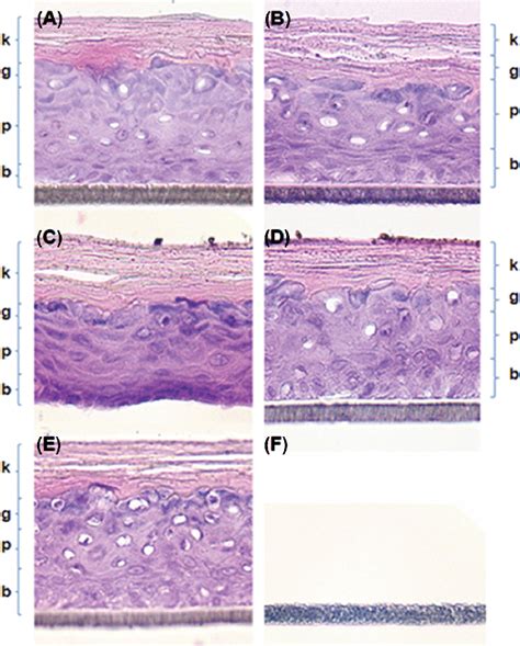 Histopathological Examination Of The Epiderm Tm 3d Human Skin Model By