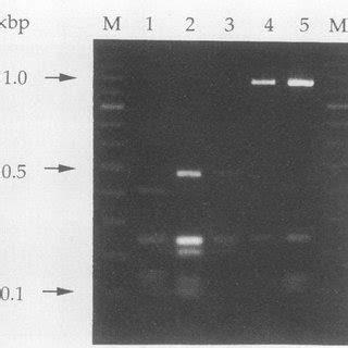 Restriction profiles of the phase 1 flagellin gene from different... | Download Scientific Diagram