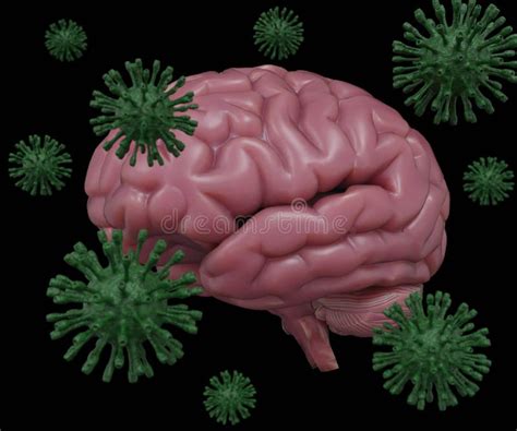 Human Brain With Virus Is Attacking Healthy Human Brain Stock