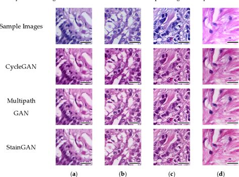 Figure 3 From Impact Of Hande Stain Normalization On Deep Learning Models