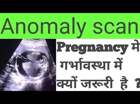 Pregnancy Me Anomaly Scan Kab Karna Chahiye Anomaly Scan Level Tow